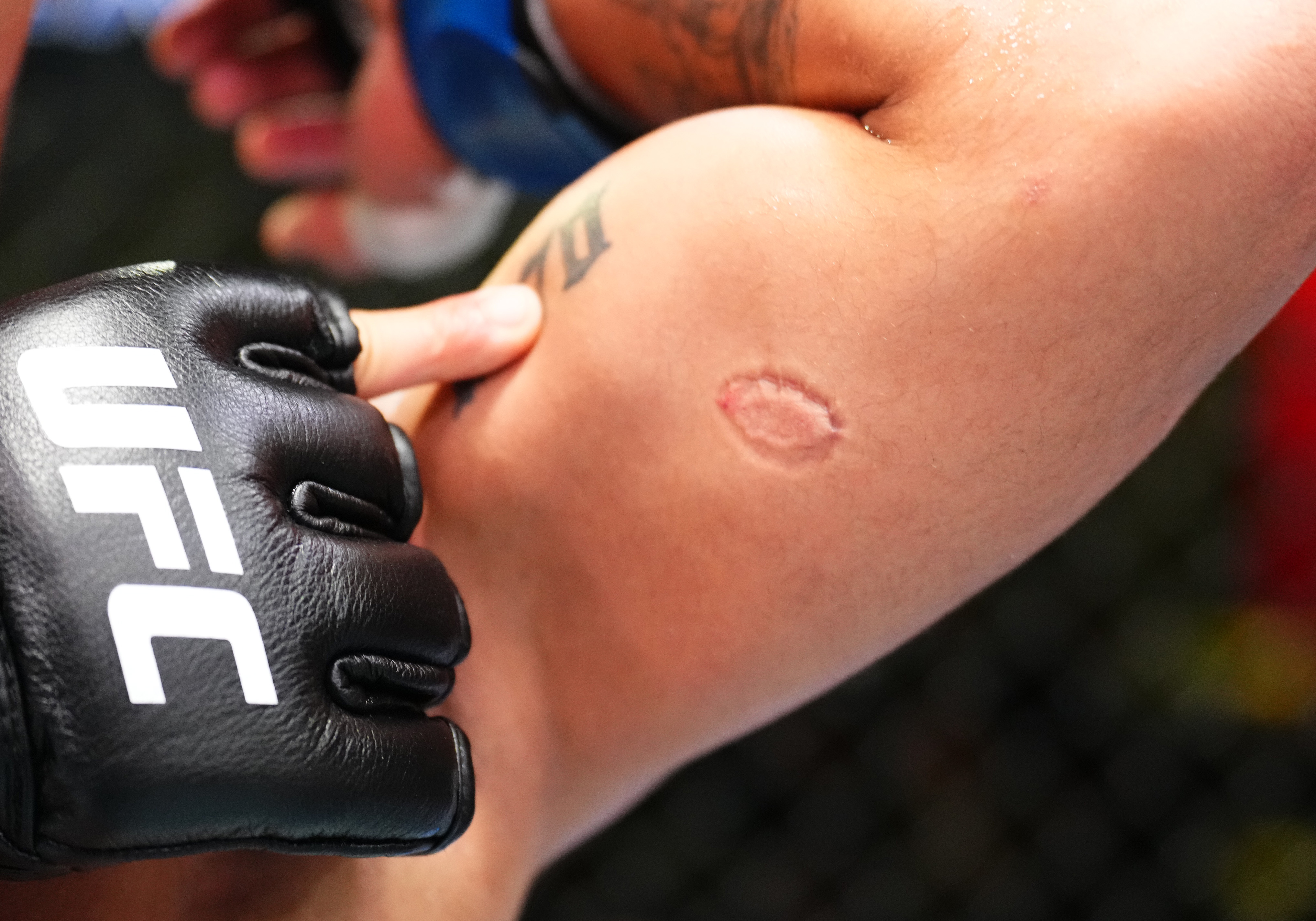 Severino left teeth marks on the left arm of his fellow Brazilian