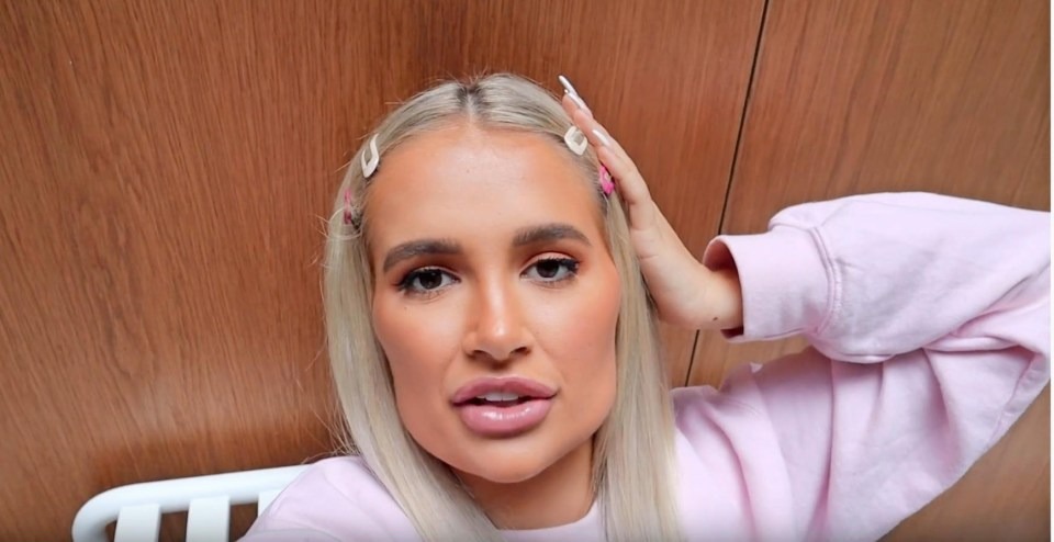 Molly-Mae made the decision to dissolve her fillers after this picture went viral