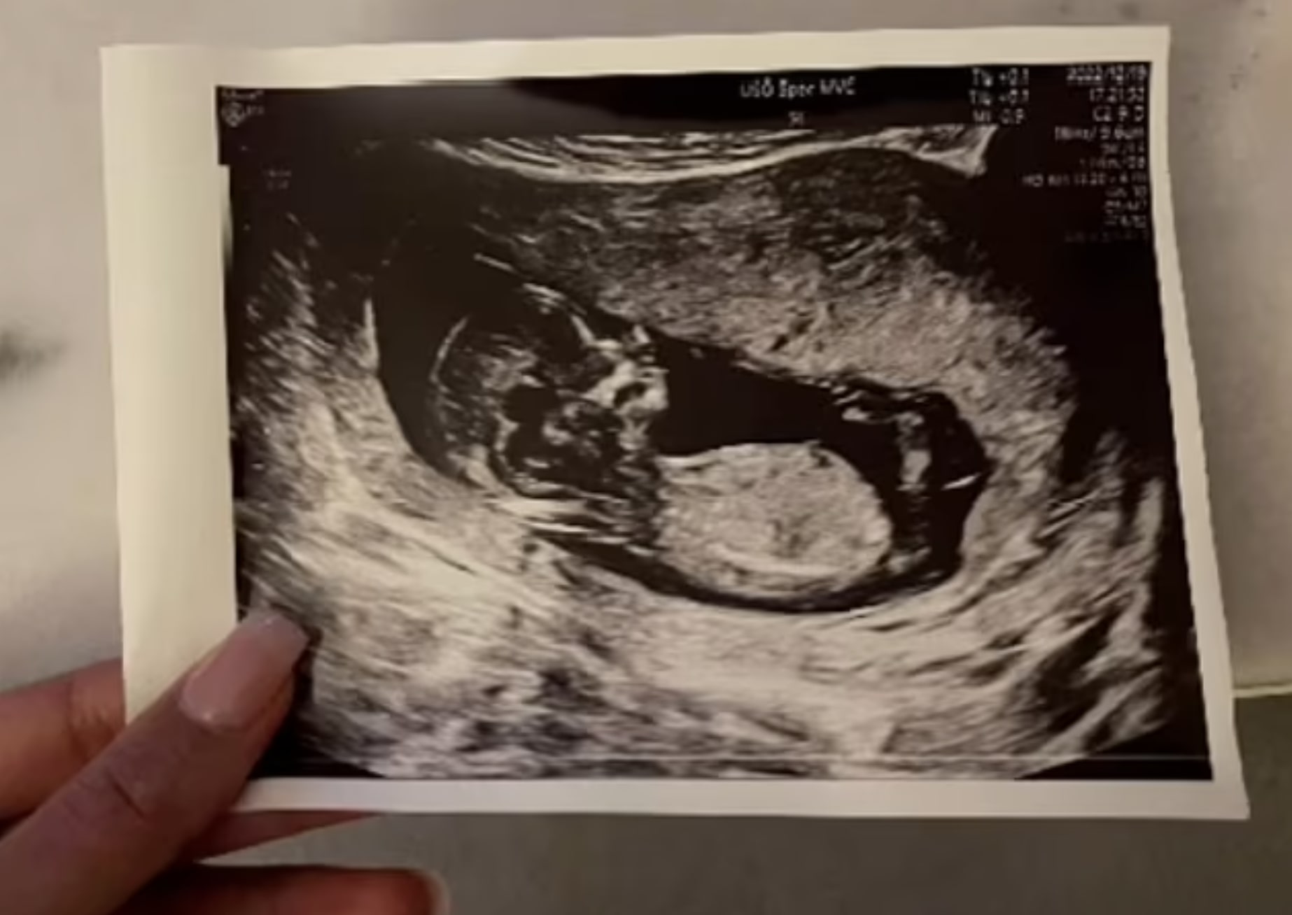 She even shared an ultrasound picture with her loved ones