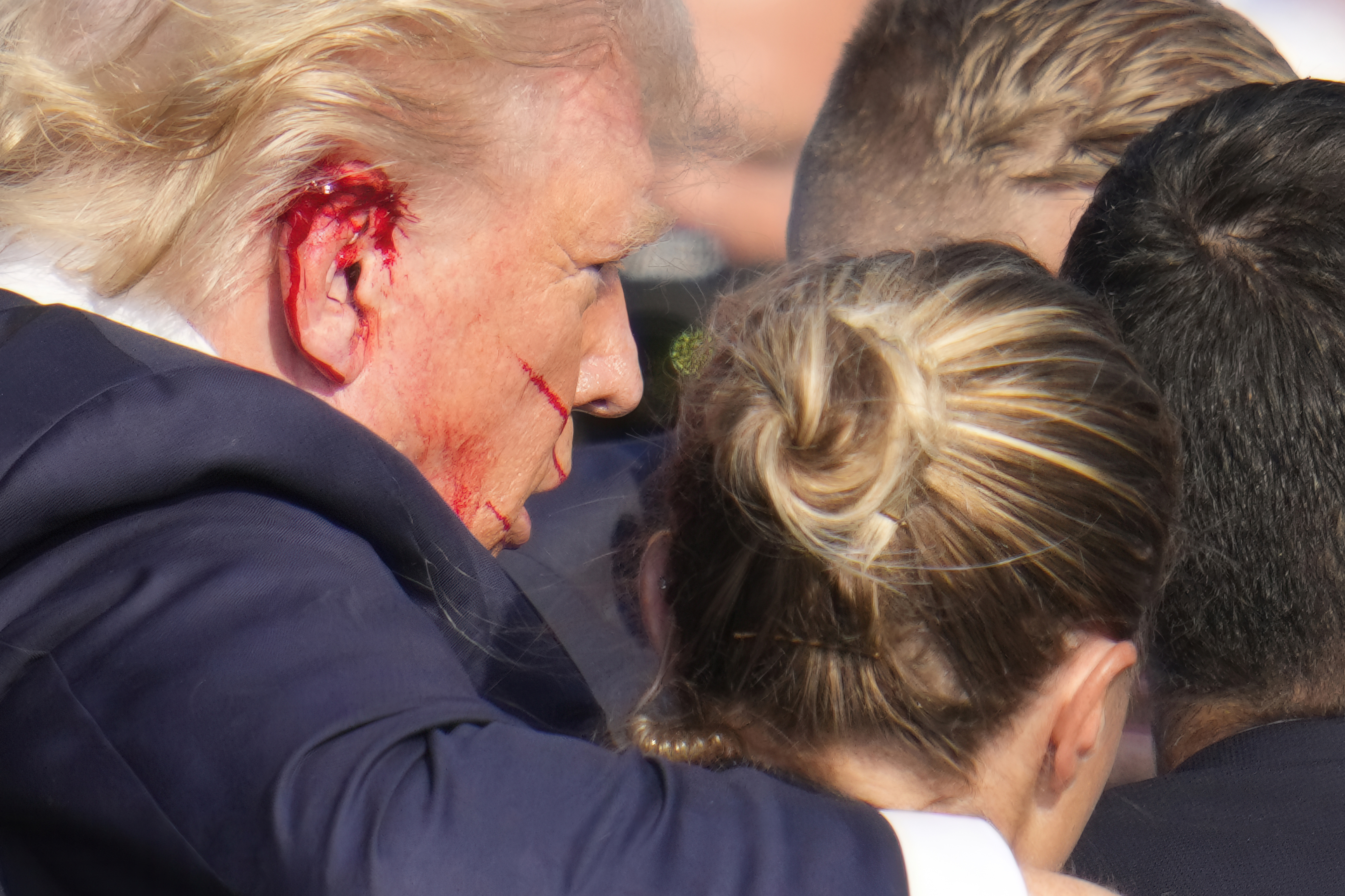 Blood is smeared across Trump's ear after the shooting